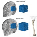 These images show a comparison between bone mass in a hunter-gatherer and an agriculturalist hip joint. Photo: Timothy Ryan and Colin Shaw