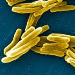 Tuberculosis bacteria under an electron microscope. (Janice Haney Carr photo courtesy Centers for Disease Control and Prevention (U.S.))