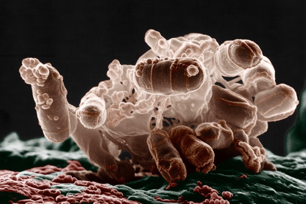 A colourized low-temperature electron micrograph of a cluster of E. coli bacteria. Individual bacteria in this photo are oblong and colored brown. (Eric Erbe photo and colourization by Christopher Pooley courtesy ARS/USDA)
