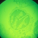 A macrophage (immune response) cell in early stages of infection with African swine fever virus, magnified about 1,000x. (Keith Weller photo courtesy ARS/USDA)