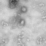A transmission electron microscopy image of the first isolated case of the new 2019 coronavirus, as obtained by Reuters on Jan. 27, 2020. (Handout image courtesy IVDC, China CDC via Reuters)