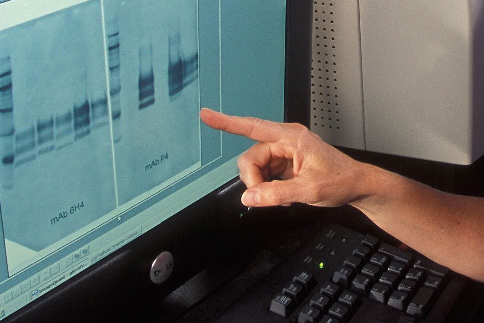 A Western blot analysis, used to detect specific proteins in tissue samples, is used to confirm BSE in cattle. (Peggy Greb photo courtesy ARS/USDA)
