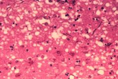 A microscope-level view of damaged brain tissue from a cow infected with BSE. (USDA photo via U.S. Food and Drug Administration)