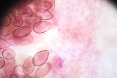 The end of a parasite control era