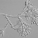 Photo micrograph of a new species of Penicillium originating from soil that AAFC is in the process of describing.