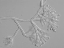 Photo micrograph of a new species of Penicillium originating from soil that AAFC is in the process of describing.
