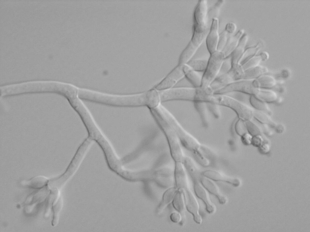Photo micrograph of a new species of Penicillium originating from soil that AAFC is in the process of describing.